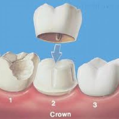 crown-illustration